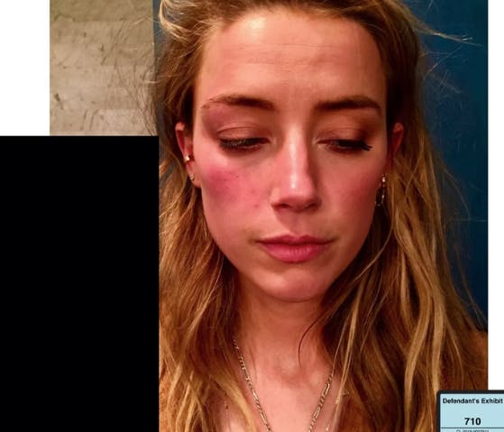 Det er billeder som dette, Amber Heard bliver beskyldt for at have haft gennem en redigering.