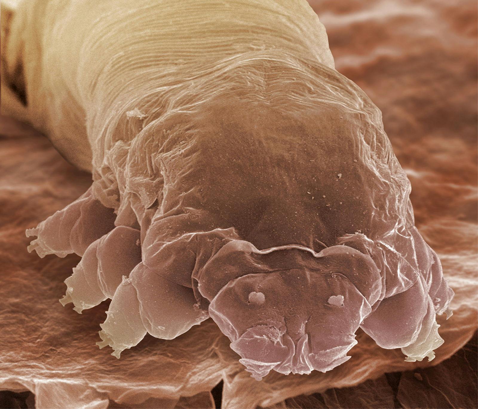 Miderne er kun 0,3 mm lange. De har ingen anus, så de dør af forstoppelse. 
