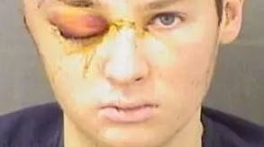 20-årig patient voldtager sin terapeut