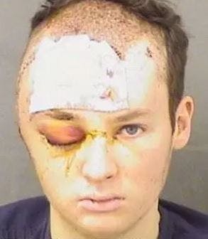 Den 20-årige patient var allerede som mindreårig blevet sigtet for seksuelle forbrydelser.