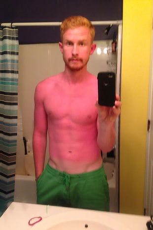 Er det en rød reje? Er det postmand Per i sin røde bluse? Nej, det er en solbrændt mand. 