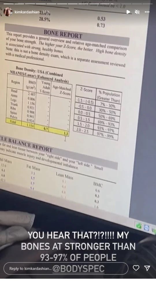 Her kan man se Kim Kardashians stærke knogler.