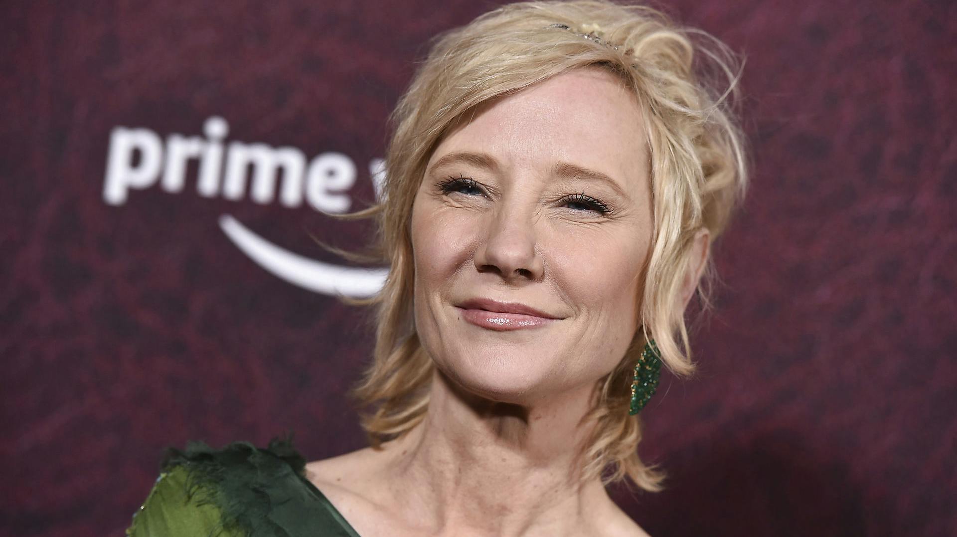 Anne Heche er indlagt på hospitalet med alvorlige kvæstelser. 