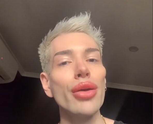 Selv om Davids ansigt allerede er forandret gevaldigt, så er han endnu ikke færdig med operationerne.