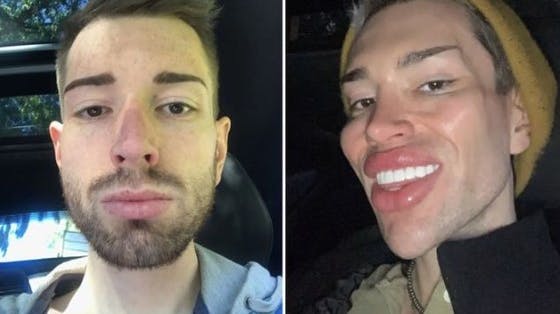 David har på ganske få år ændret sit udseende markant.