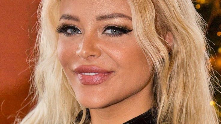 Elvira Pitzner har over 400.000 følgere på Instagram.