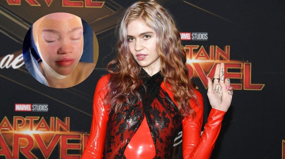 Grimes har tilsyneladende fået opereret sine ører.