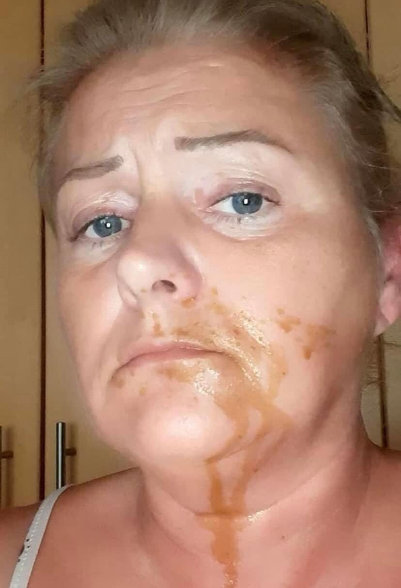 Mums! Amanda blev mål for hundens voldsomme diarré.