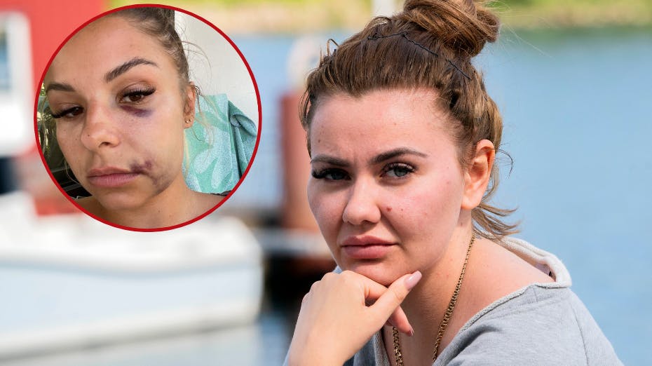 Der er ingen tvivl om, at Fie Laursen er ganske uforstående over for de mange hadske kommentarer.