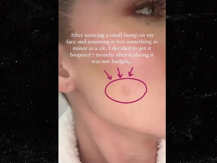 Her viser Khloé Kardashian den lille tumor frem.
