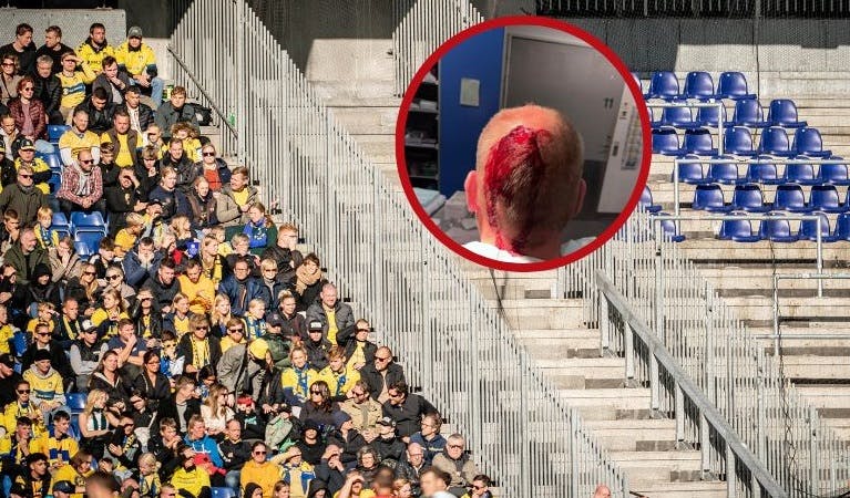 En Brøndby-fan fik sig en voldsom skade i baghovedet efter kampen mod FCK.