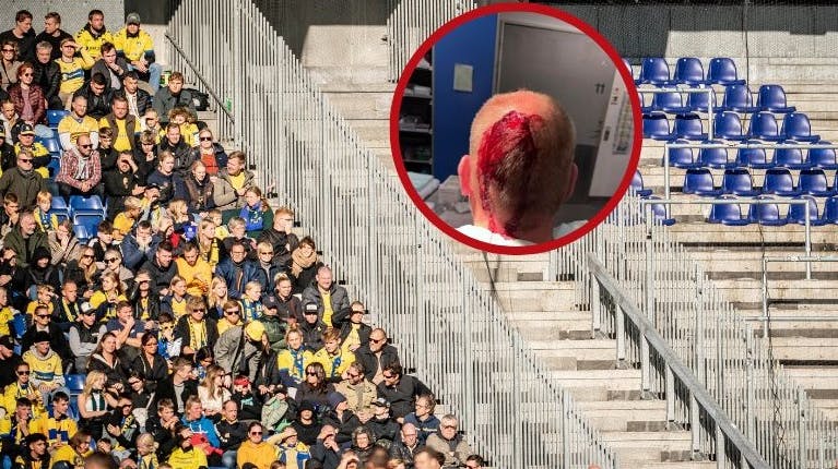 En Brøndby-fan fik sig en voldsom skade i baghovedet efter kampen mod FCK.
