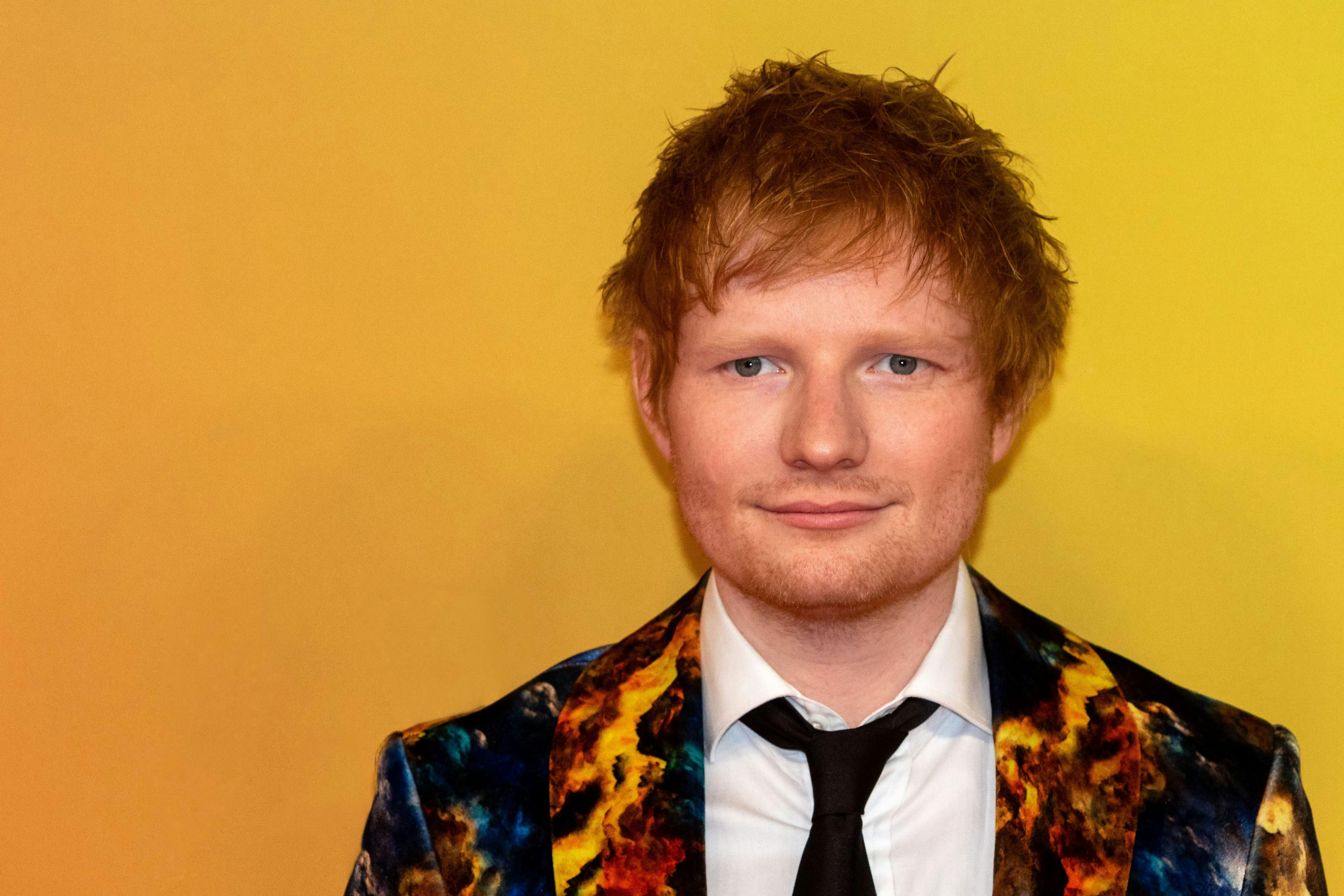 Ed Sheerans hårfarve er bare en af mange kvaliteter ved den talentfulde singer/songwriter.