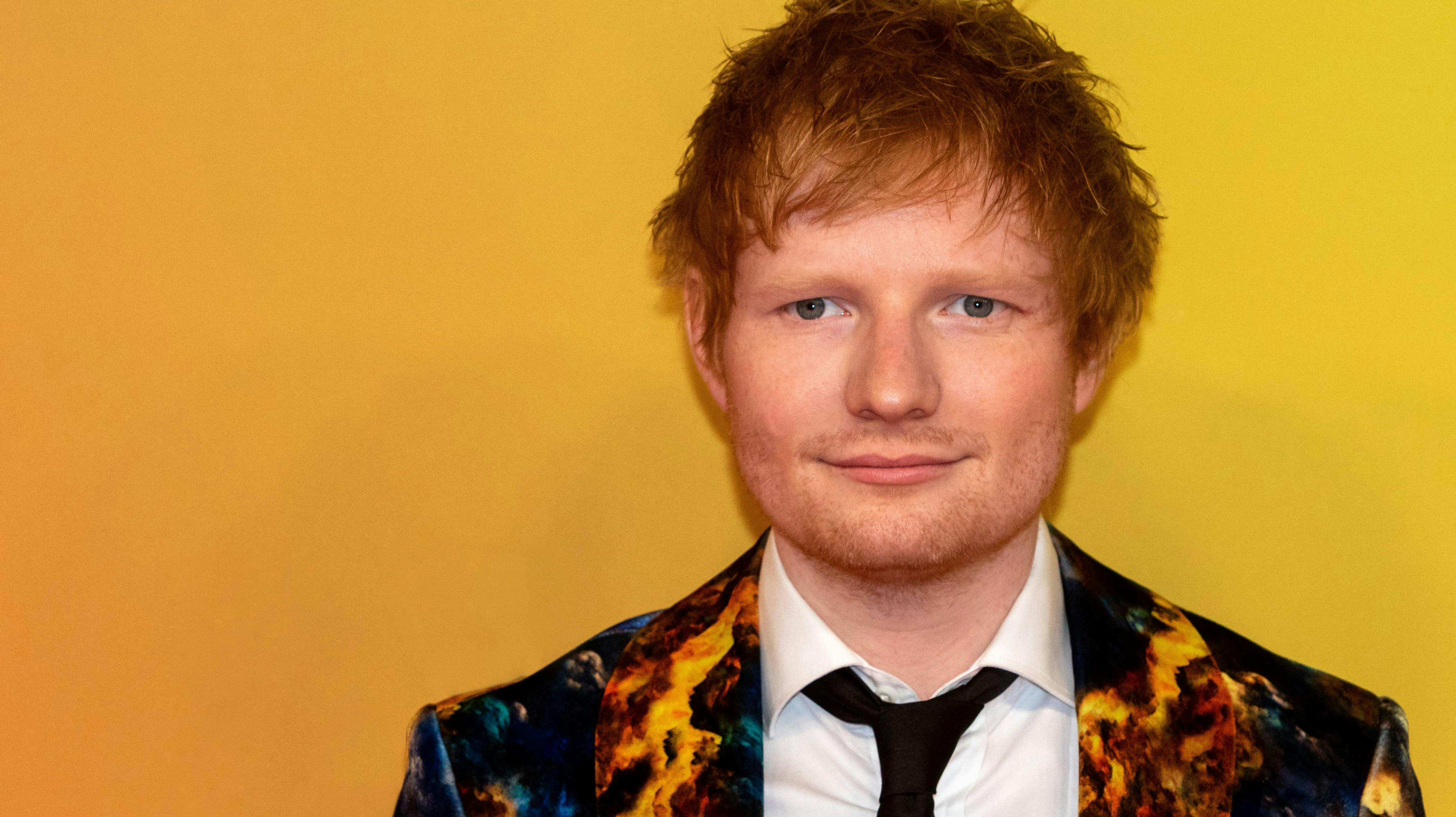 Ed Sheerans hårfarve er bare en af mange kvaliteter ved den talentfulde singer/songwriter.