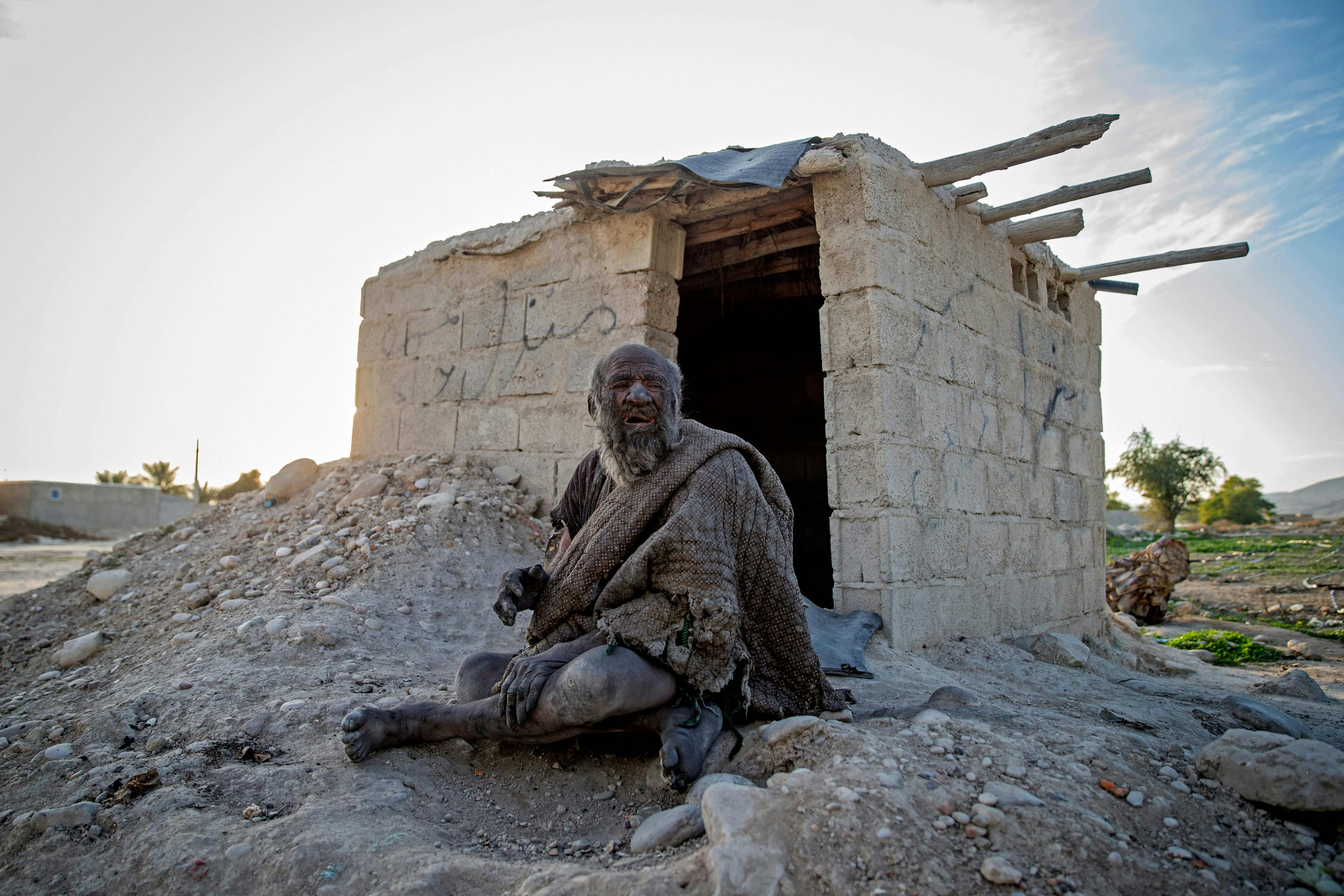 Beboerne i byen Dejgah havde bygget en murstenshule til den iranske mand, der for alt i verden undgik vand og sæbe. Han levede angiveligt af hulepindsvin, fordærvet kød og masser af cigaretter&nbsp;
