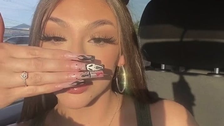 En kvinde ved navn Tess fortæller, at flere har kaldt hendes næse for grim.