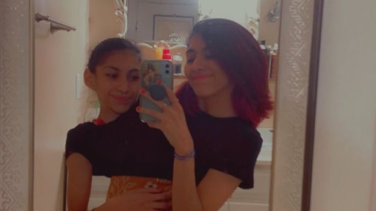 De 22-årige mexicanske kvinder har hver to arme, men må deles om et sæt ben, da de er sammenvokset ved navlen.