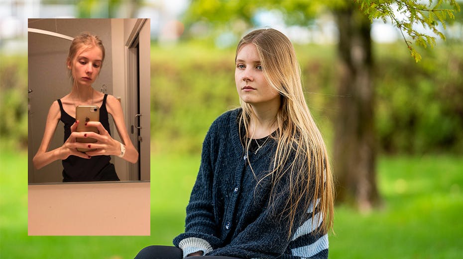 Agnes var indlagt i et halvt år efter sit hjertestop. I den første tid kunne hun kun indtage ernæringsdrik, så kroppen vænnede sig til føde.