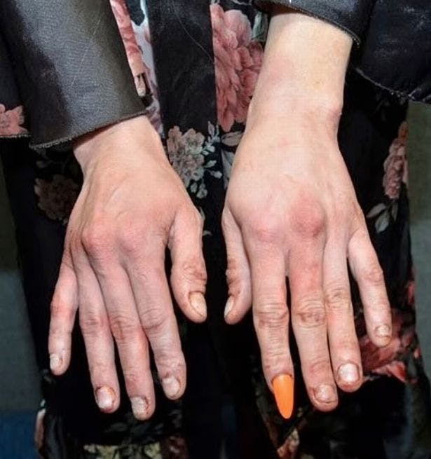 Selv Courtney Clenneys hænder var sølet ind i blod efter knivstikkeriet. 