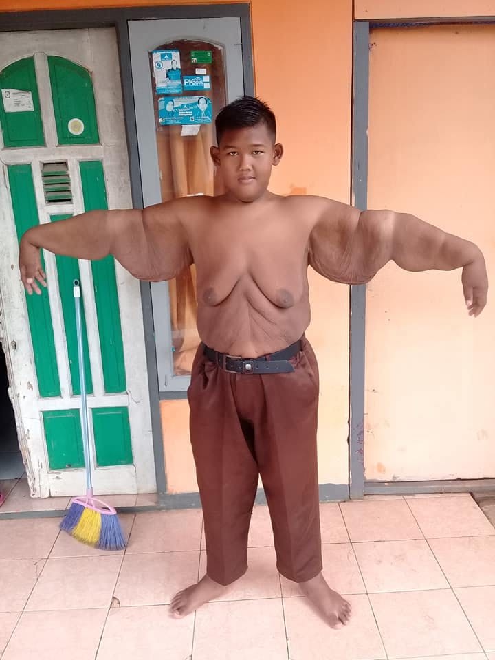 Arya Pernana vejer nu 87 kilo.&nbsp;
