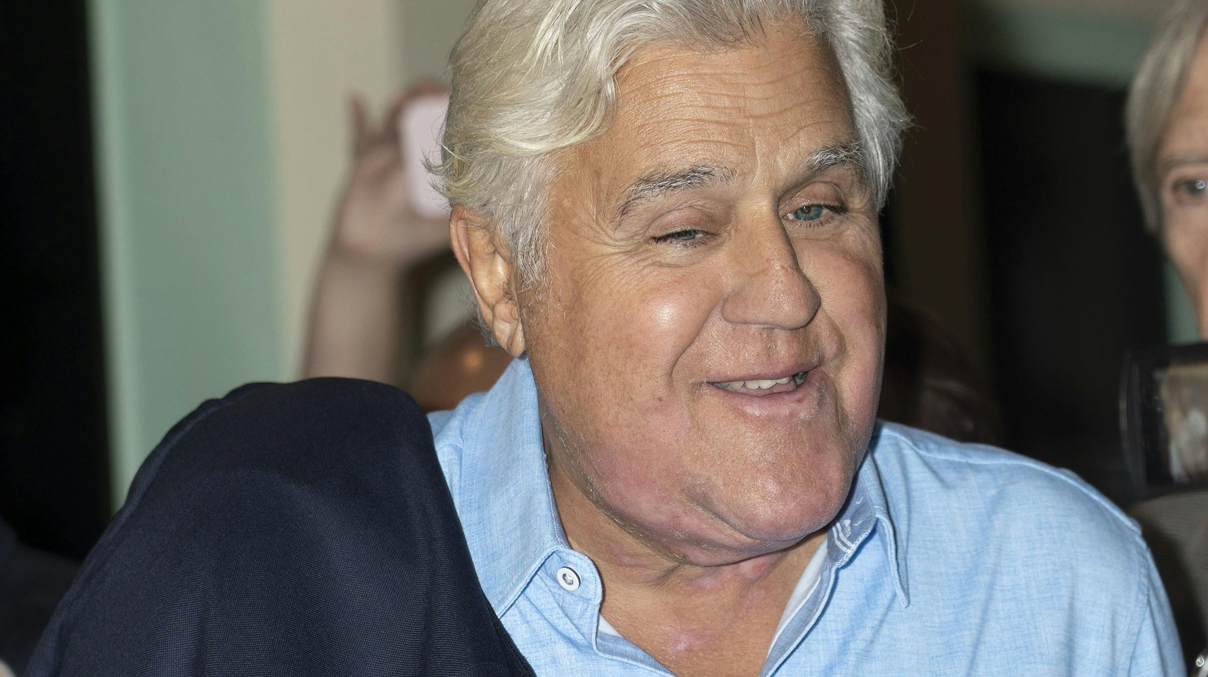 Jay Leno ligner nærmest sig selv, efter han blev svært forbrændt efter en ulykke på hans bilværksted. nbsp;