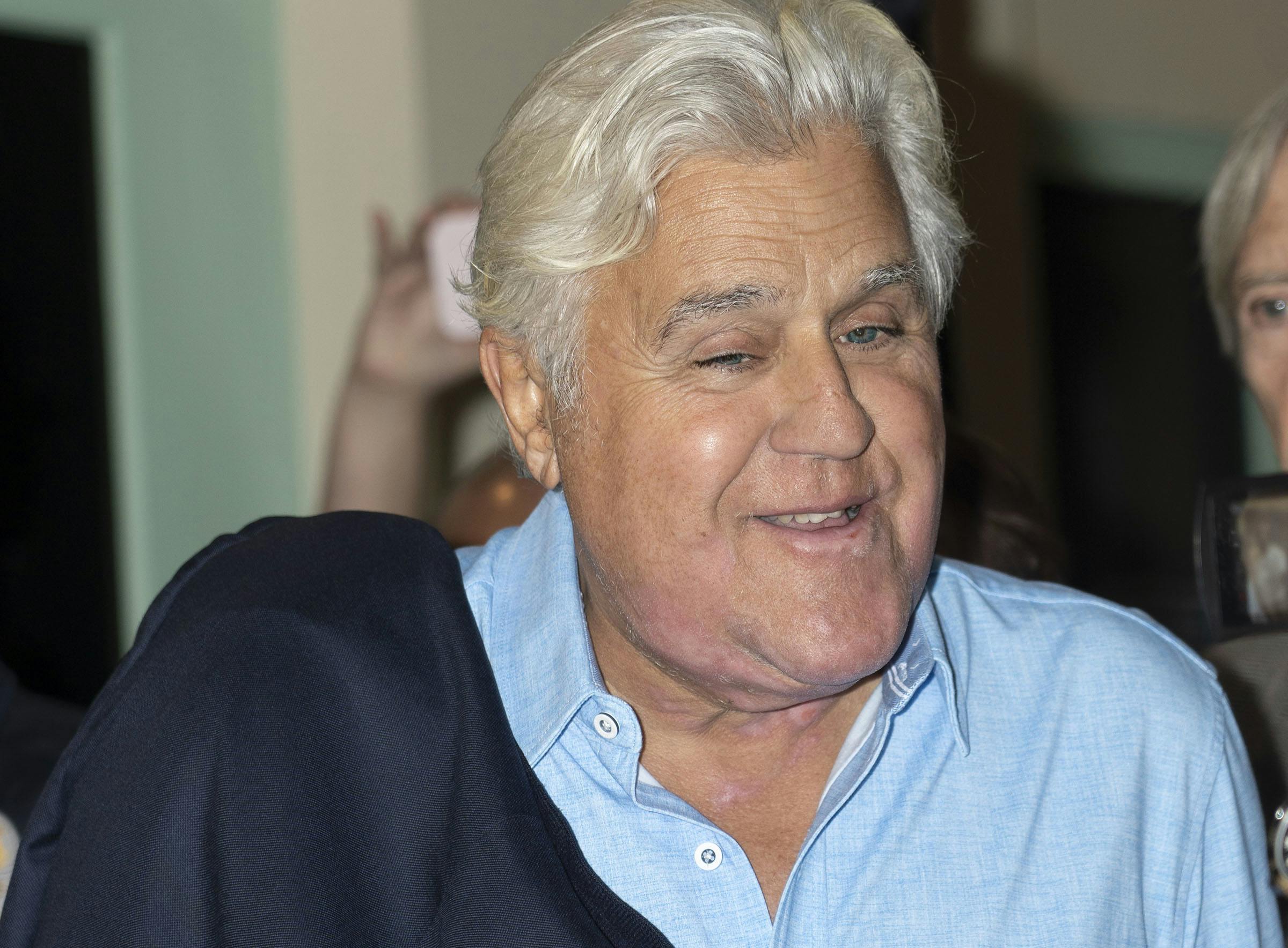 Jay Leno ligner nærmest sig selv, efter han blev svært forbrændt efter en ulykke på hans bilværksted. nbsp;