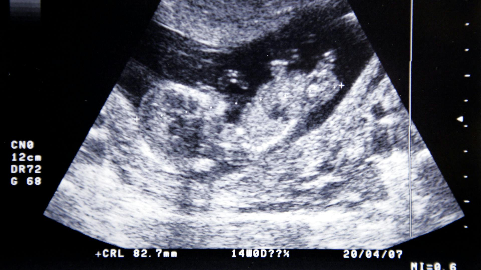 Man kender endnu ikke identiteten på de fire spædbørn, der i weekenden blev fundet i en fryser.