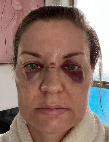 Sådan ser den australske fan ud nu.