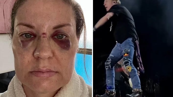 En kvindelig fan blev ramt af den mikrofon, som Axl Rose kastede under koncerten.