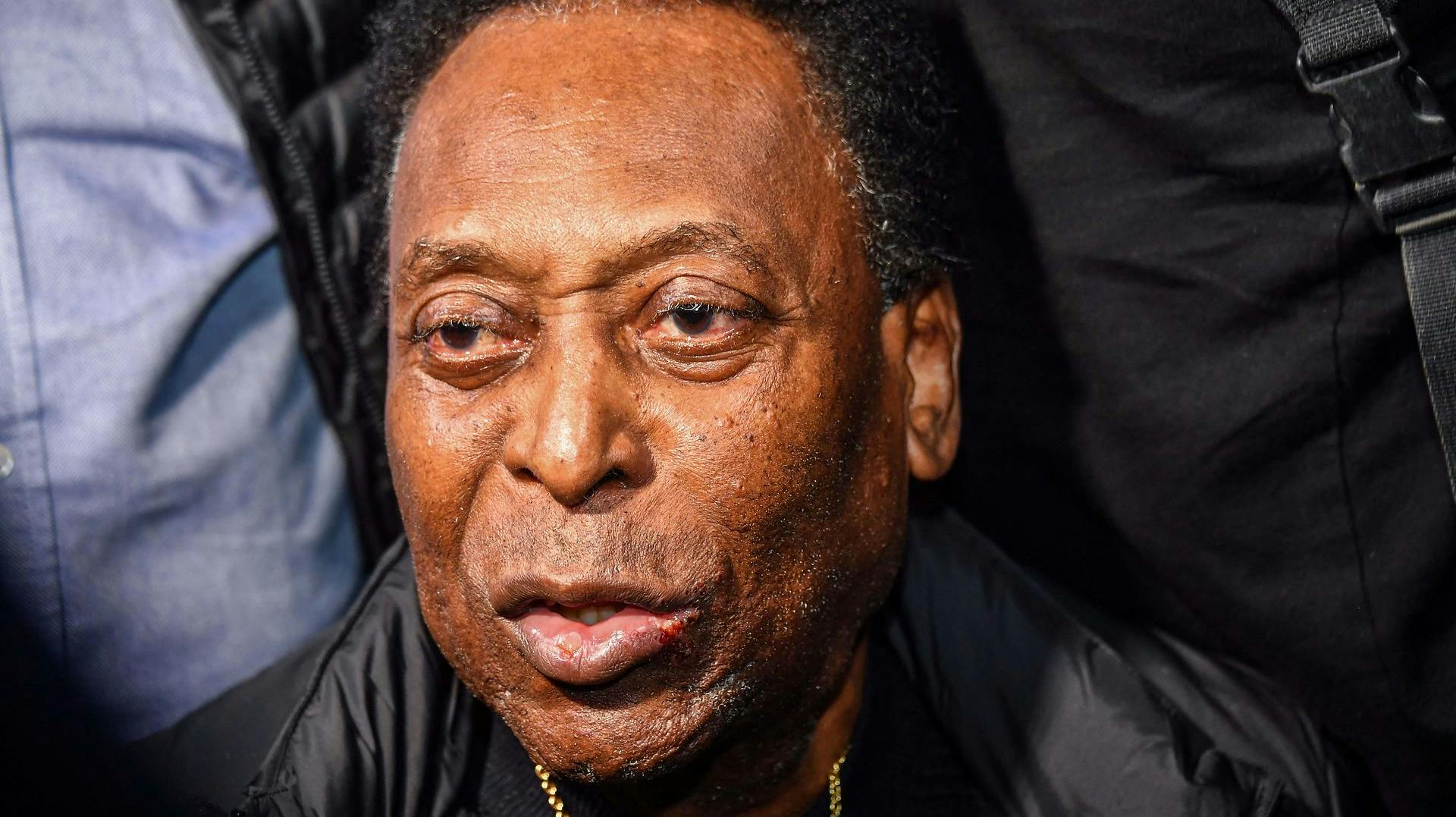 Pelé er fortsat indlagt på Albert Einstein Hospital i Sao Paulo. 