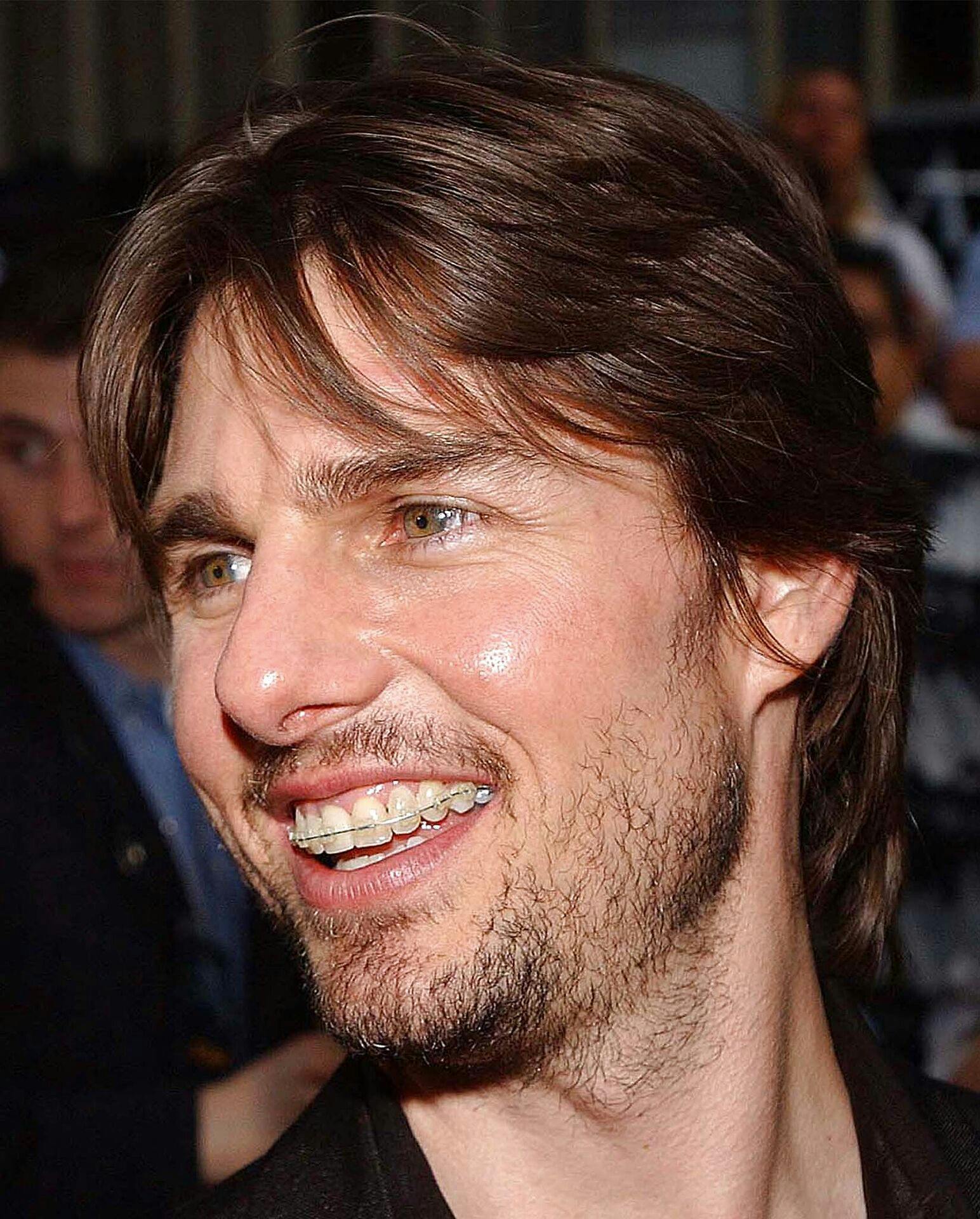 Tom Cruise fotograferet med bøjle på tænderne i 2002.