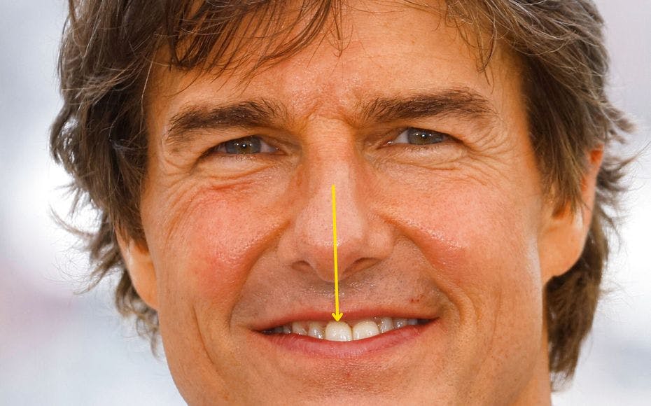 Her kan du se, hvordan Tom Cruises ene fortand sidder næsten præcis i midten af hans næse.