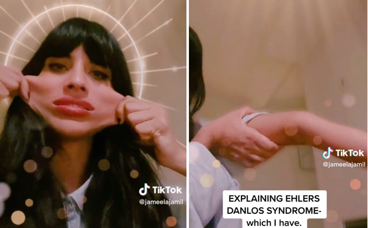 Jameela Jamil viser her sine elastiske kinder og løse albuer frem.