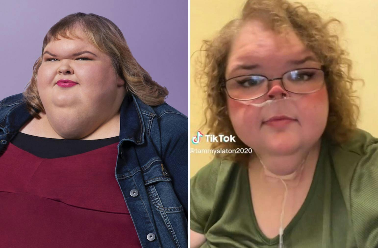 Det er tydeligt at se, at der er røget en del kilo af Tammy Slaton.