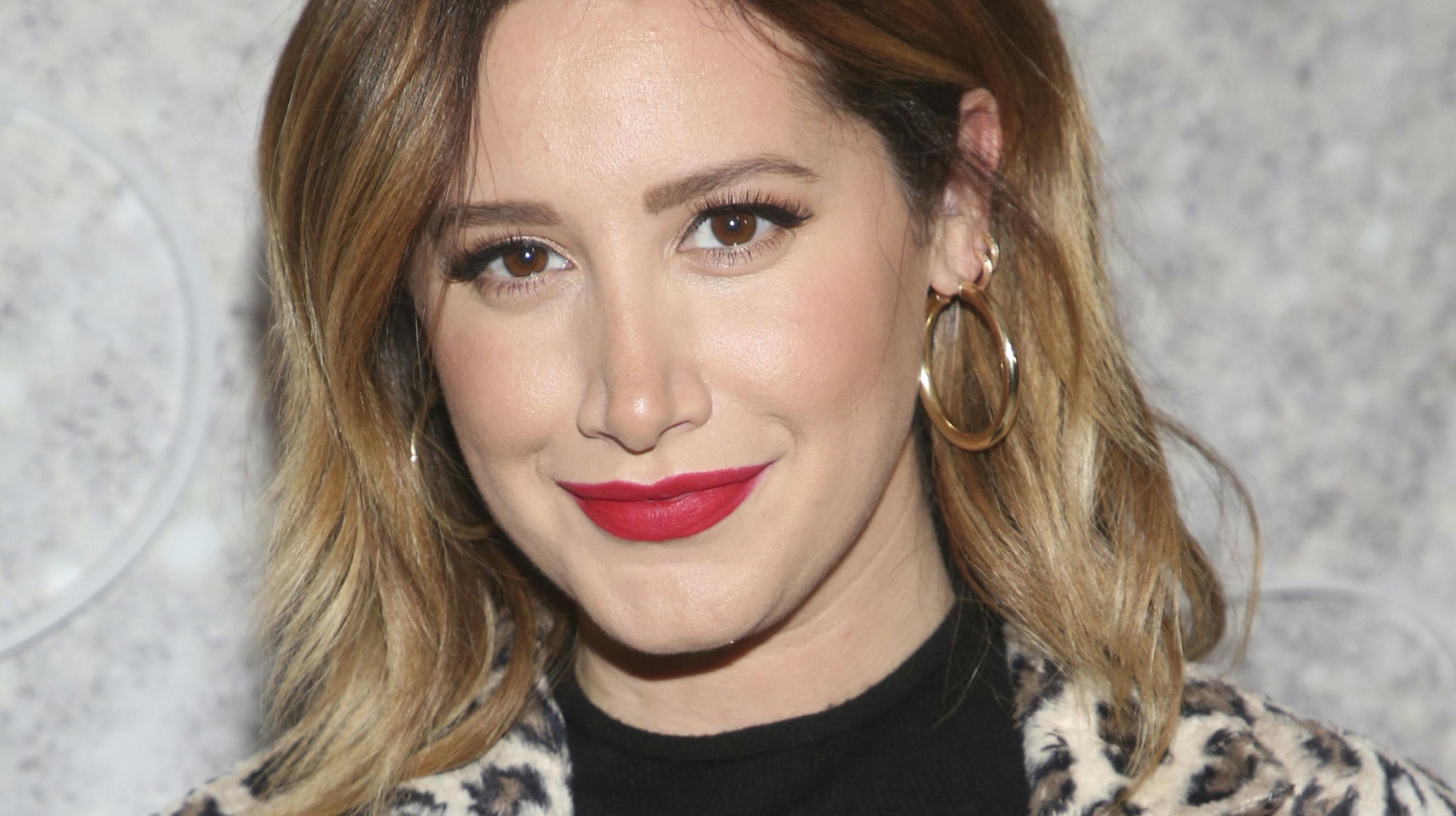 Skuespilleren har døjet med hårtab siden, hun var i tyverne.