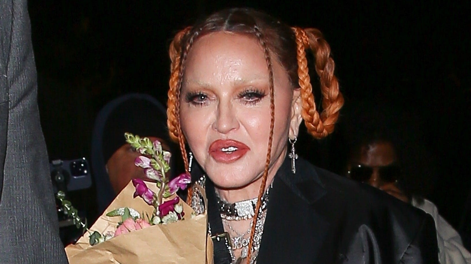 Det var operationer i ansigtet, der gjorde, at Madonna så mærkelig ud ved Grammy-uddelingen.