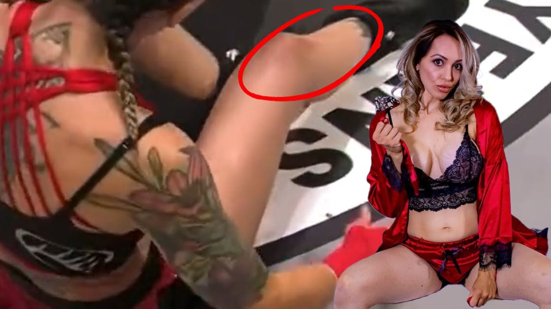 Charisa Sigala endte med at tabe kampen til trods for, at hun selv satte den brækkede ankel på plads igen. Heldigvis har anklen ikke stoppet Sigala med sit arbejde på OnlyFans.