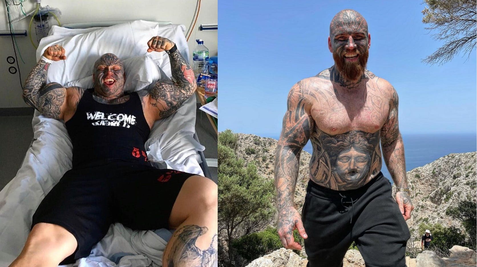 Da Jens var yngre, higede han efter hele tiden at blive større og stærkere. Det havde store konsekvenser for hans helbred, men efter flere operationer er han nu rask igen. nbsp;