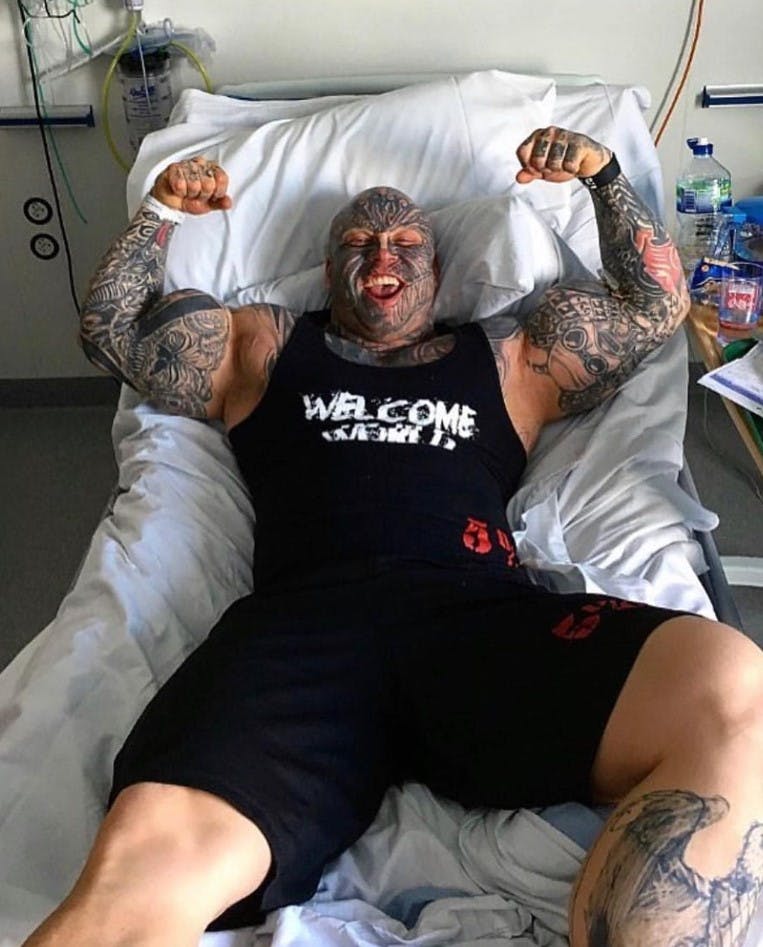 Jens da han stadig havde en masse paraffinolie i armene. 