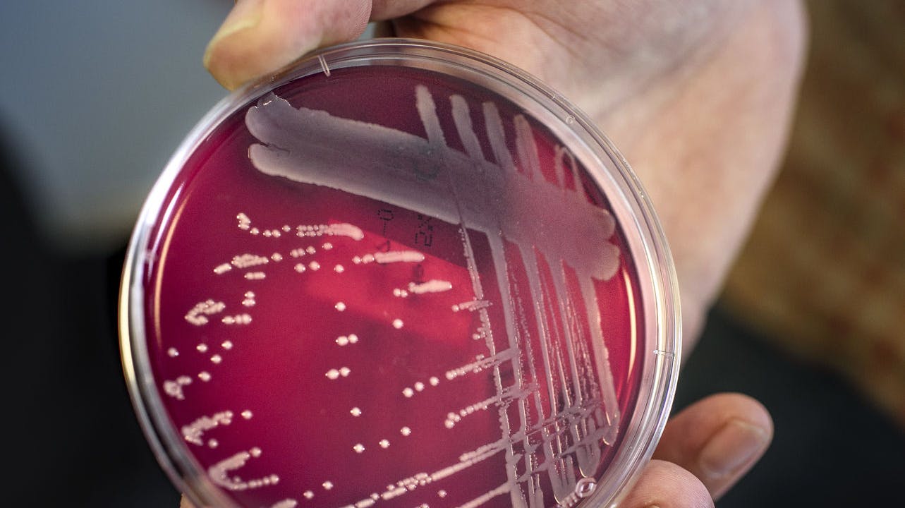 Statens Serum Institut oplyser, at invasive tilfælde af streptokokker har kostet mindst 35 danskere livet siden december. 