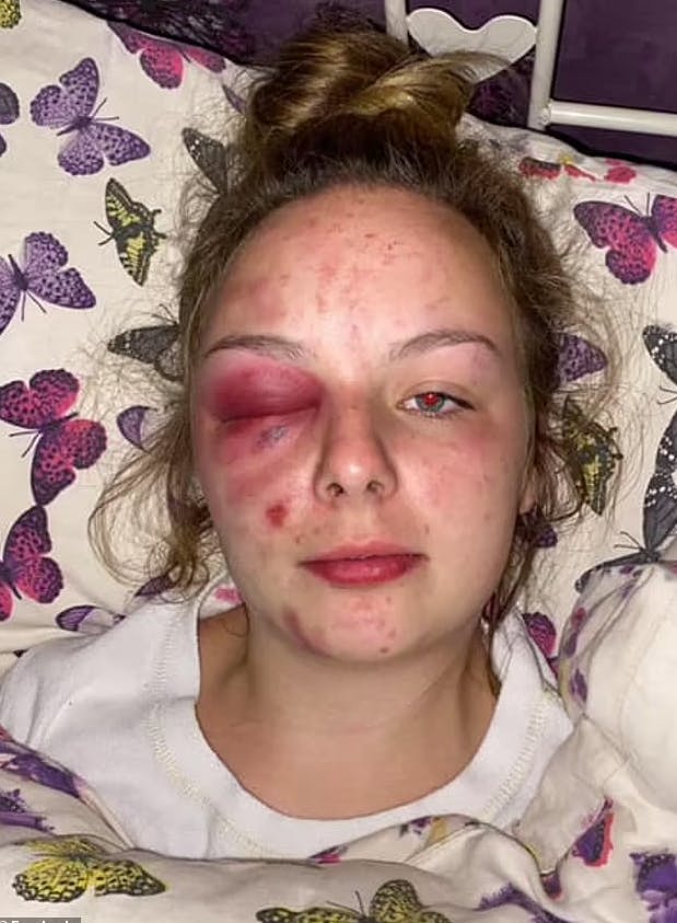 Det satte gang i en lavine, da 19-årige Eleanor Williams lagde dette billede og en række andre voldsomme billeder på Facebook.