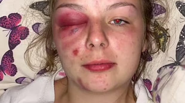 Det satte gang i en lavine, da 19-årige Eleanor Williams lagde dette billede og en række andre voldsomme billeder på Facebook.