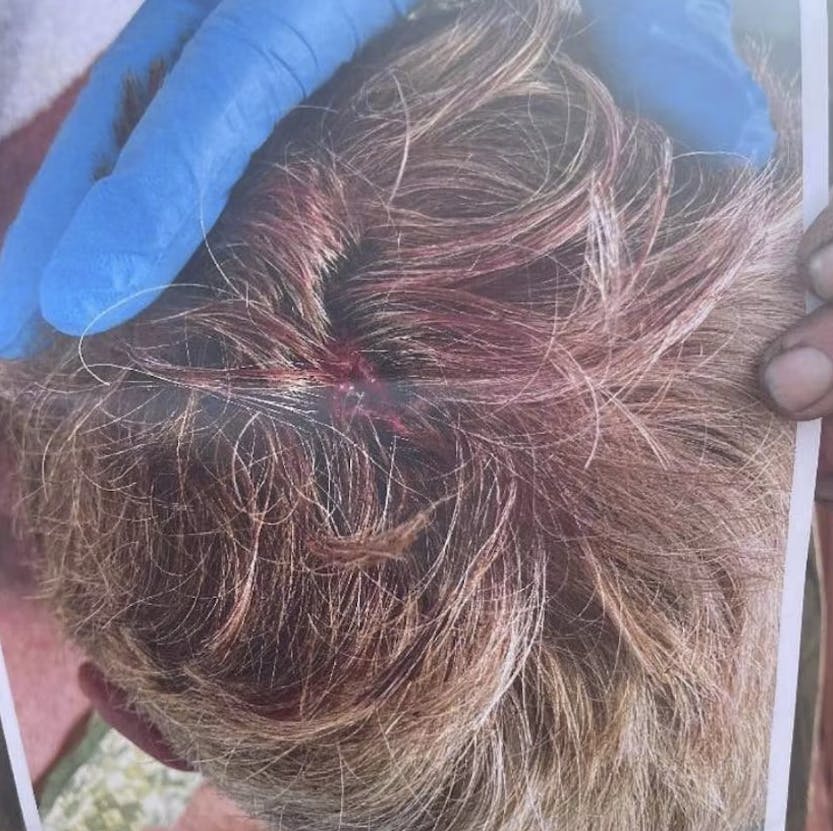 I første omgang hævdede Alex Murdaugh, at det var en ukendt gerningsmand, der havde skudt ham. Senere indrømmede han dog, at han selv havde iscenesat sit eget drabsforsøg.