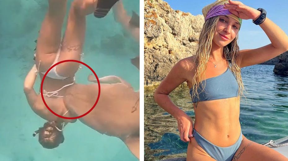 En kvinde blev bidt i armen under en snorkel-tur på Maldiverne. 