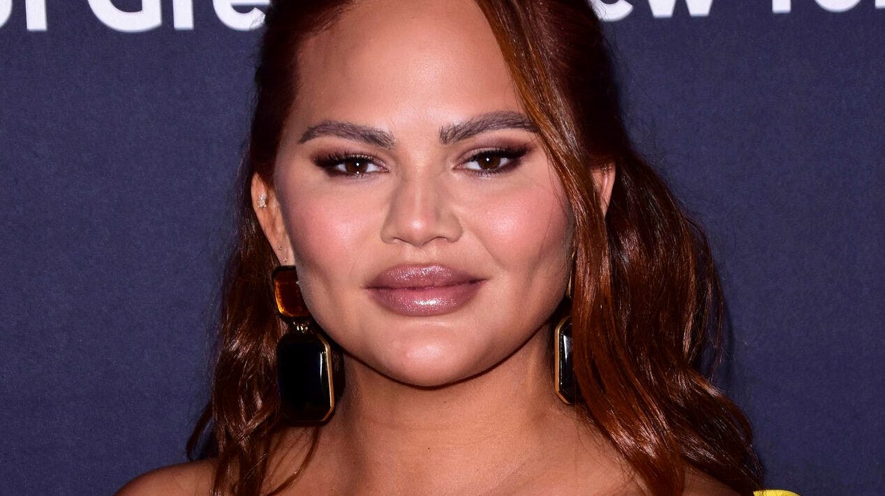 Chrissy Teigen har på sin Instagram-profil delt et meget ærligt post fødselsbillede.