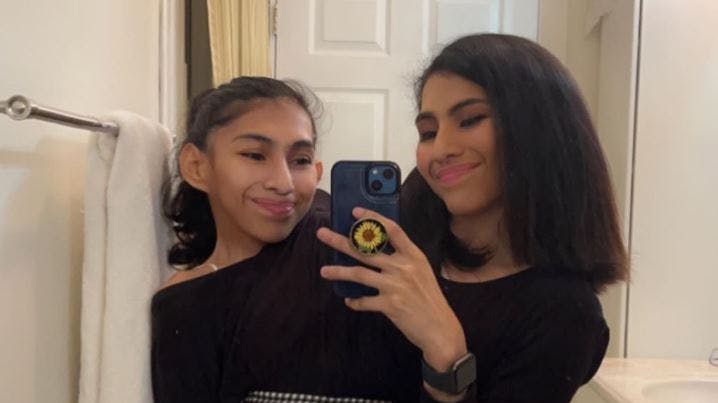 Carmen og Lupita er siamesiske tvillinger