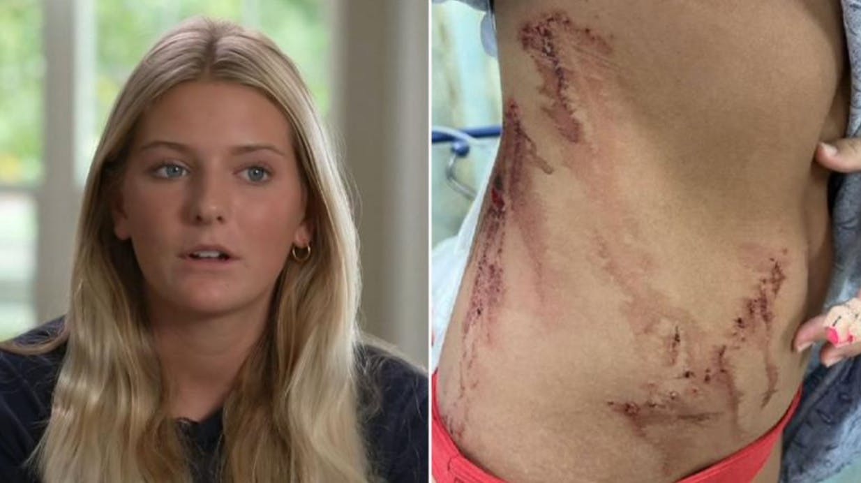Ella blev i sidste uge angrebet af en haj, mens hun badede med en veninde i Florida. Nu står hun frem. nbsp;
