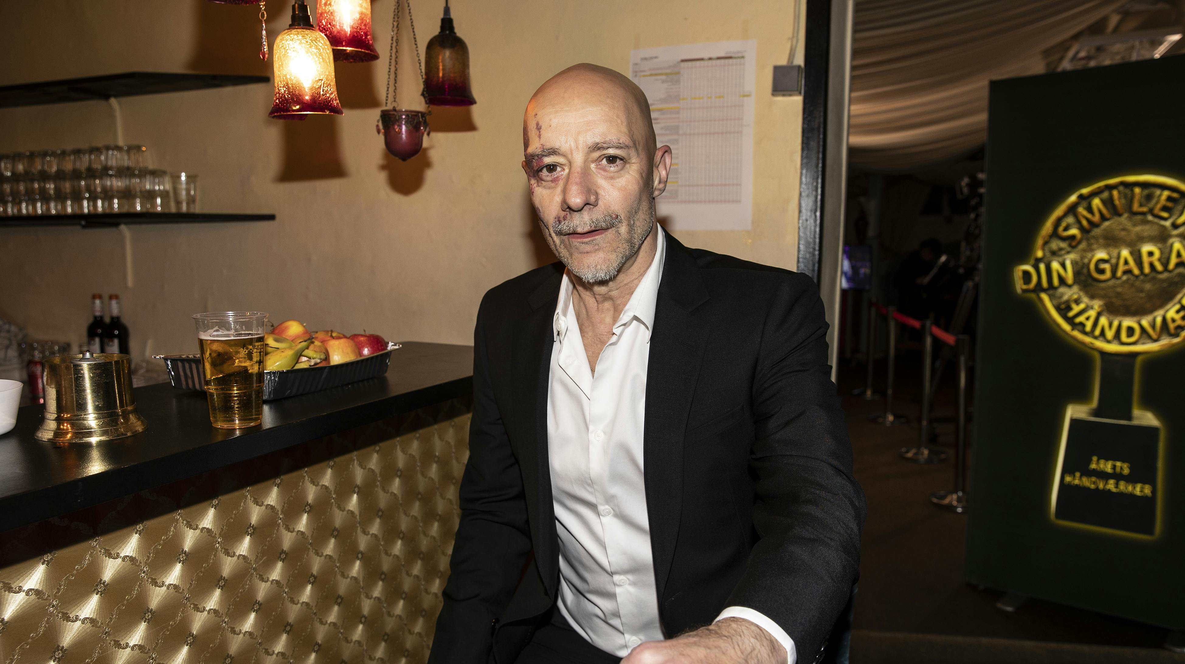 Jimmy Jørgensen afslører en ret vild historie om, hvordan han startede sin musikerkarriere. 