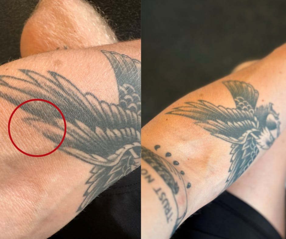 Emils tatovering har ikke haft godt af kontakten med "Robinson"-rebet.
