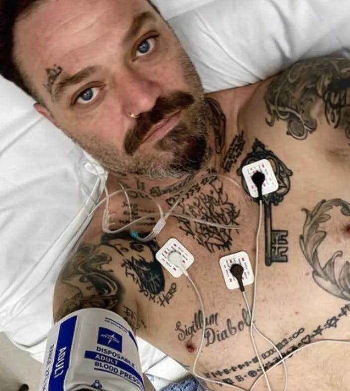 Bam Margera havde tilsyneladende taget så mange piller, at hans hjerte var ved at stå af. 